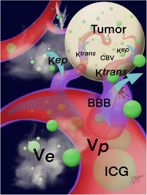 Intraoperative Real-Time Near-Infrared Image-Guided Surgery to Identify Intracranial Meningiomas via Microscope